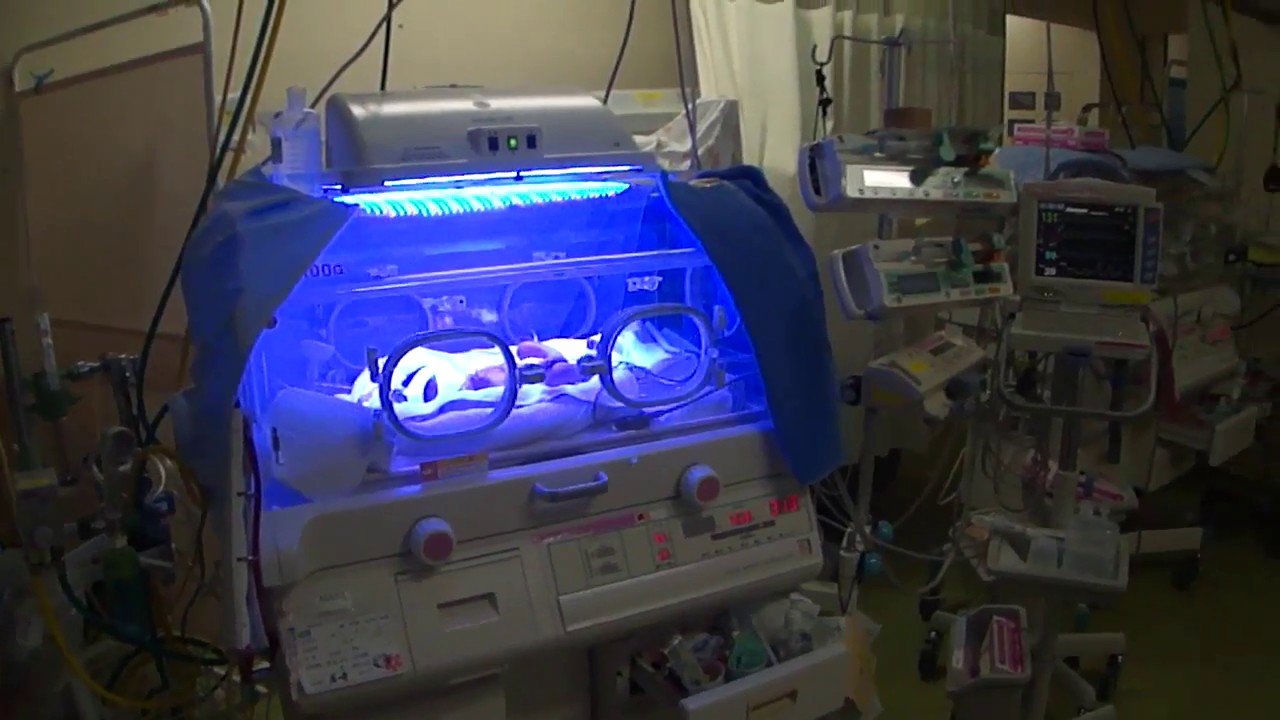 赤ちゃんの光線治療の様子（NICU）