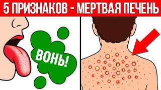 Ваша печень скоро умрет! / Как быстро проверить здоровье печени?