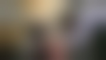 Open fracture management - orthopaedic teaching video Cape Town