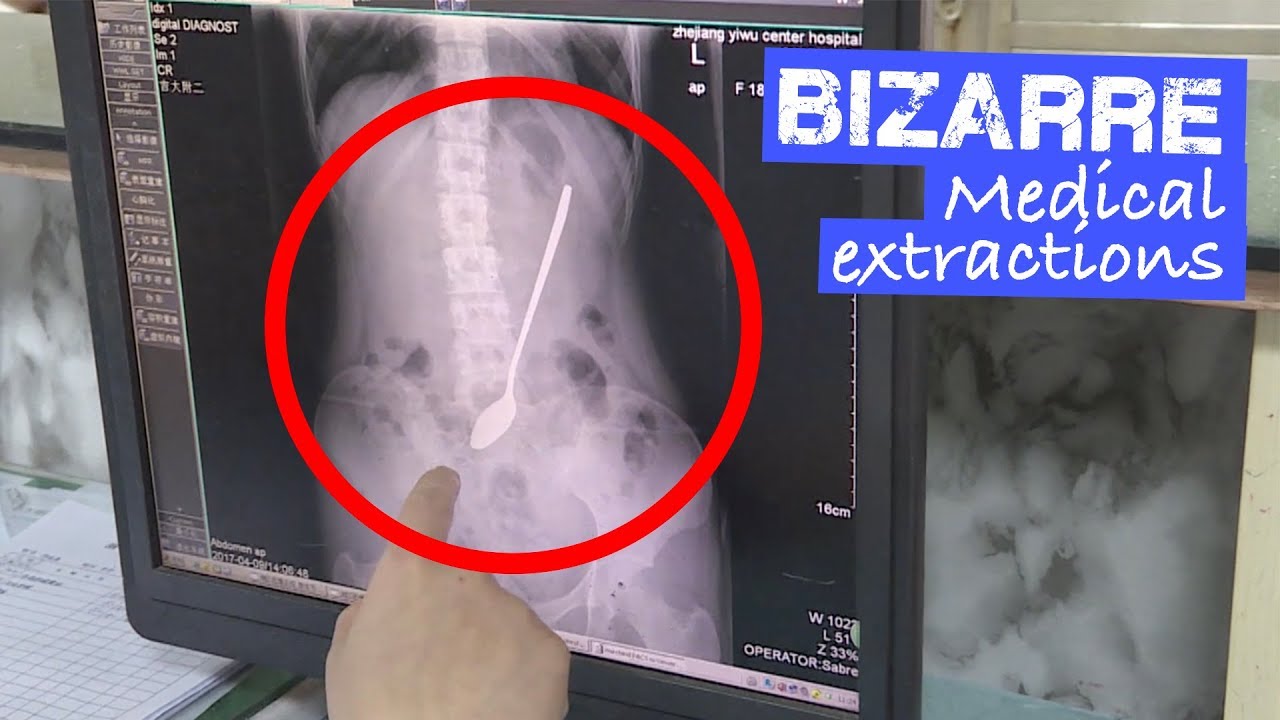 Mad medical procedures from the past Mad medical procedures from the past
