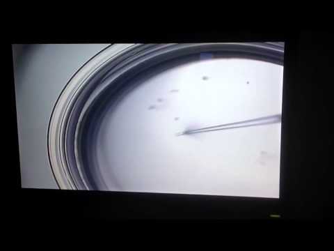 icsi---intracytoplasmic-sperm-injection-at-arc-fertility-centre-chennai