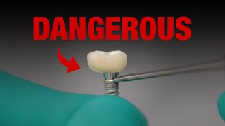 This implant FAILED. Are you making the same mistake