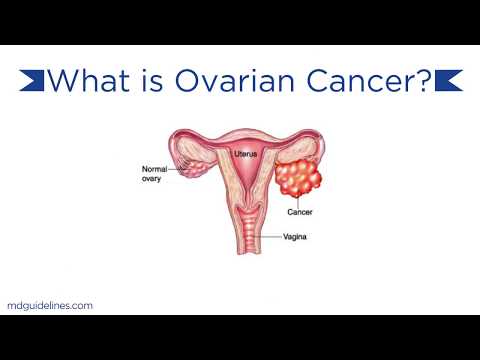 Ovarian Cancer Causes and Treatments