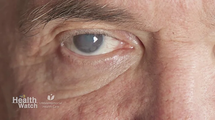The Effects of Aging on Our Eyes - DayDayNews