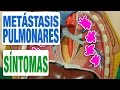 Todos los Síntomas de las Metástasis en los Pulmones