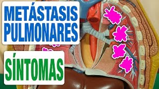 Todos los Síntomas de las Metástasis en los Pulmones