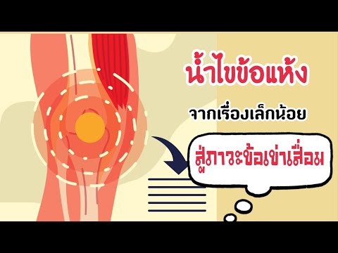 ปวดเข่า สาเหตุ อาการ