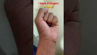 i have 4 fingers 😭😂🤣#viralshort