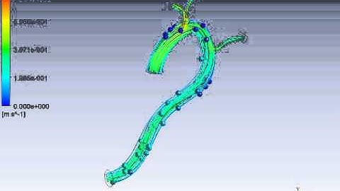 carreau model of blood_100particles simulation