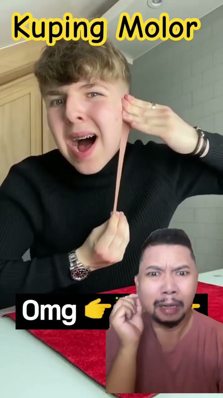 KUPING MOLORNYA JANGAN DITARIK!!!?? #comedy #funny #duet #viralvideo #shorts
