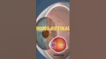 AI Retinal Disease Detector: for more details: WhatsApp us @ +94769111820