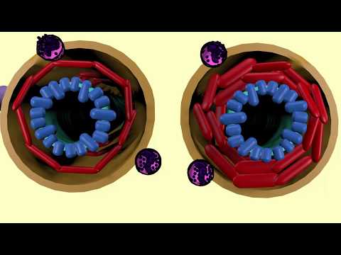 Βίντεο: Ο όγκος του Dreaded Mast Cell