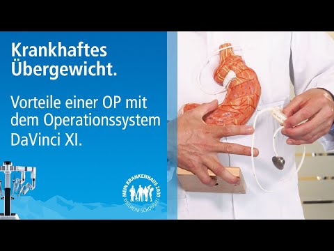 Adipositas / bariatrische Chirurgie | Magenband, Schlauchmagen, Magenbypass OP mit dem DaVinci XI