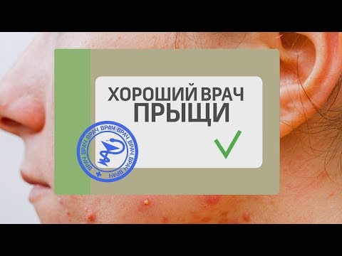 Хороший Врач как избавиться от ПРЫЩЕЙ?