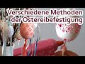 Ostereier aufhängen bzw. befestigen - 9 Methoden - Tutorial