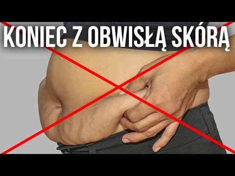 Wideo: Jak Usunąć Nadmiar Skóry Brzucha?