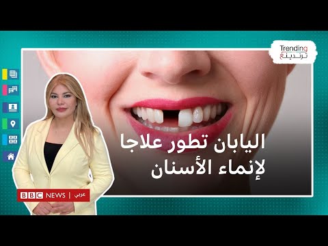 اليابان تطور أول علاج لإنماء الأسنان