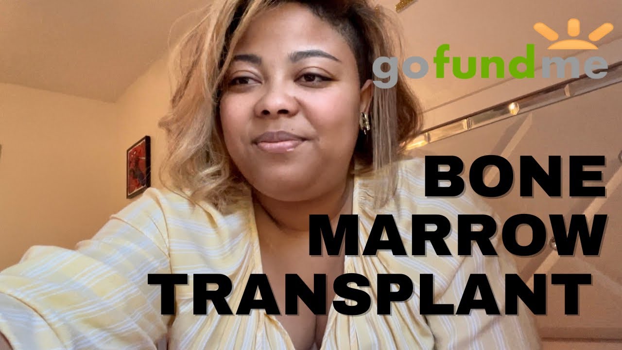 Bone Marrow Transplant for Sickle Cells Disease YouTube