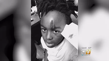 First Grader Hospitalized After School Fight, Mom Demands Accountability