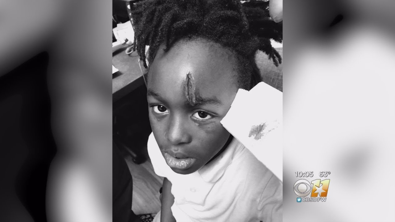 First Grader Hospitalized After School Fight Mom Demands