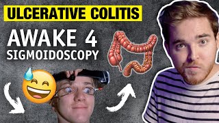 Sigmoidoscopy Story (NO ANETHESIA!) - Ulcerative Colitis Diagnosis | My IBD Journey with UC