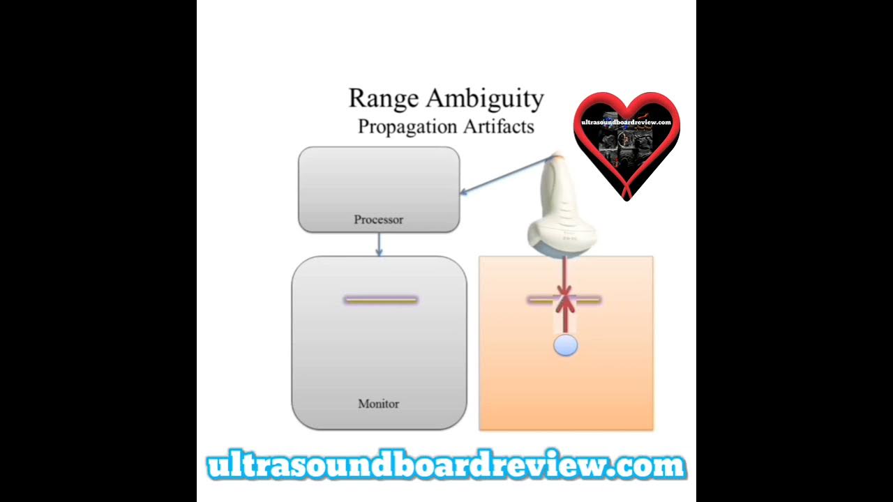 Range Ambiguity Ultrasound Artifacts YouTube