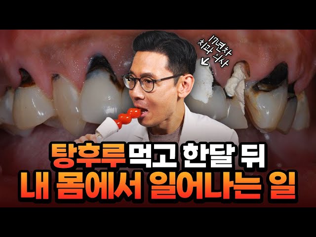 한 달 뒤 치과가서 🐶고생합니다.