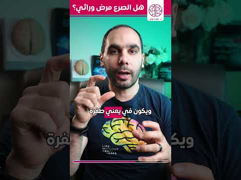 هل الصرع حالة وراثية