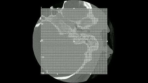 CT IAC Cor 602 1