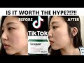 Dr. Jart Cicapair Tiger Grass Color Correcting Treatment Review | How To Use