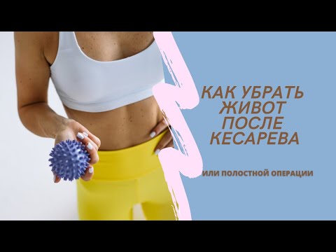 Как убрать живот после кесарева сечения. Алгоритм работы.