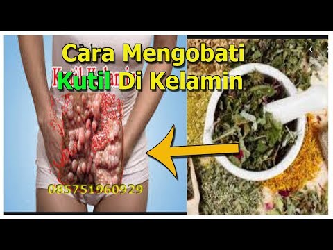 Cara Mengobati Kutil Di Kelamin Secara Alami Di Rumah