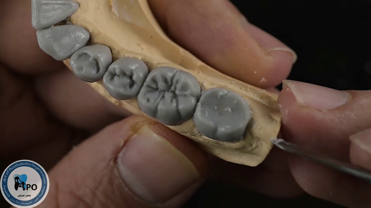 Wax up lwoer second molar -تشميع الرحى الثانية السفلية