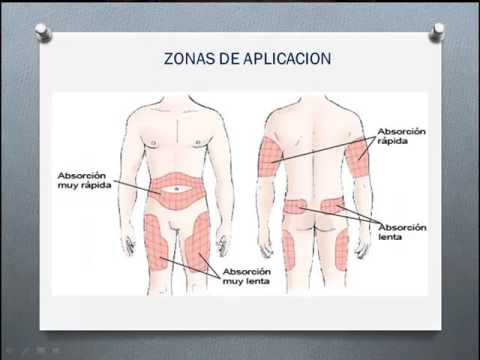 aplicacion de insulina 2 - YouTube aplicacion de insulina 2 - YouTube