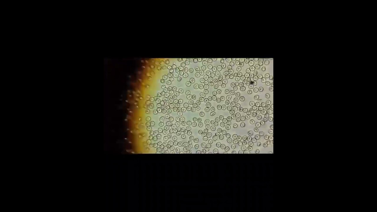 RBC Count practical performed today at guru institute of paramedical science spr.