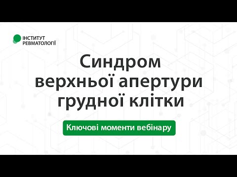 Синдром верхньої апертури грудної клітки (ключові моменти вебінару)