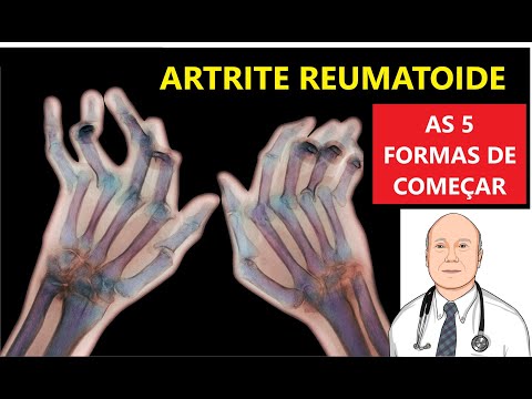 Vídeo: 5 maneiras de diagnosticar a artrite reumatóide