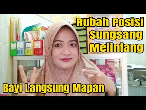 Video: Cara Menghidupkan Bayi Breech: 13 Langkah (dengan Gambar)