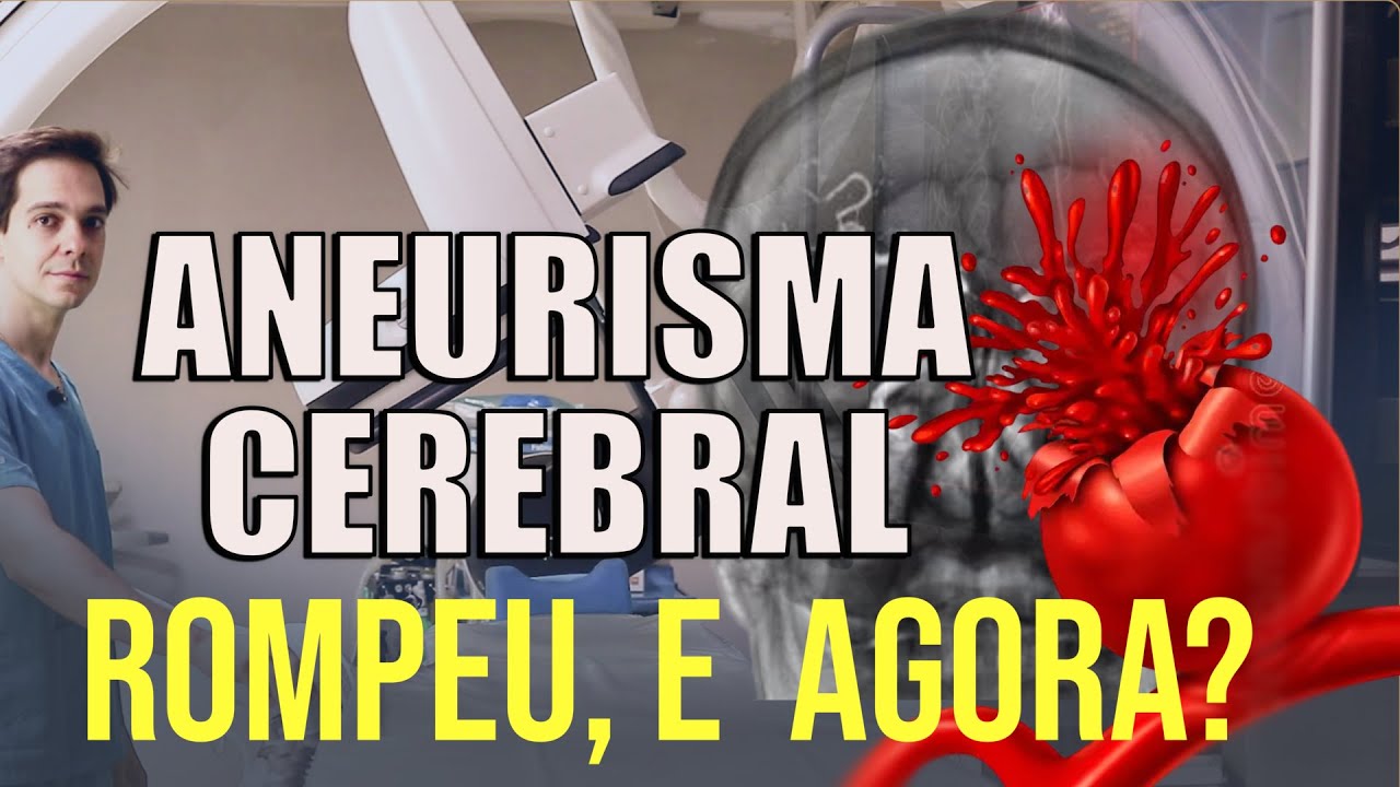 🔴 O QUE ACONTECE QUANDO UM ANEURISMA CEREBRAL SE ROMPE? |  Dr. Victor Hugo  Neurocirurgião Explica