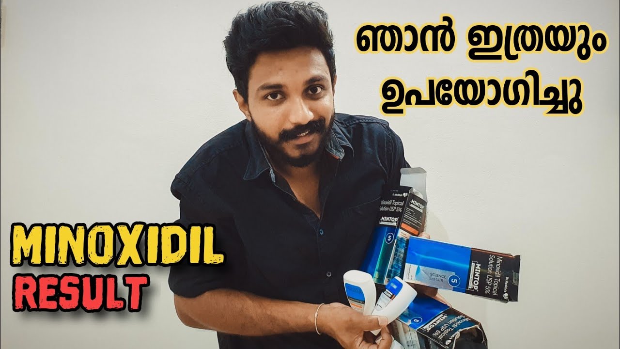 എനിക്ക് എത്ര Minoxidil il റിസൾട്ട്‌ കിട്ടി❓️ || Minoxidil Results || Hardens Beard Oil