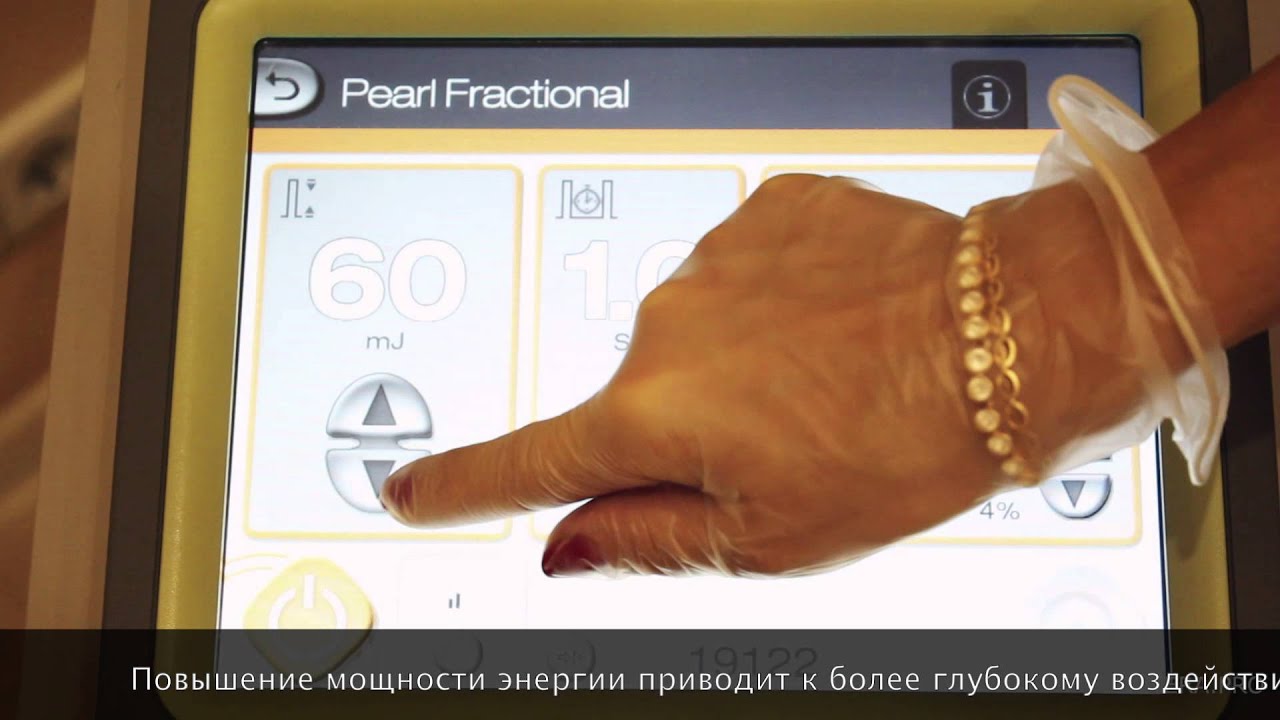 Компания Cutera представляет фракционную насадку для лазерного лифтинга Pearl Fractional