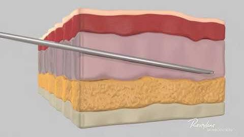 Restylane SkinBooster