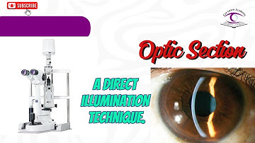 Slit Lamp Illumination: How to Perform the Optic Section