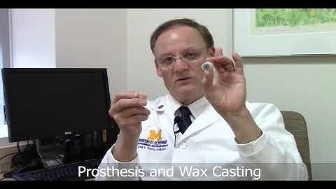 Ocular prosthetic / Prosthetic eye