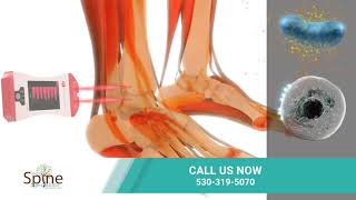 Redding Chiropractors How the Erchonia Low Level Laser Helps Treat Foot Pain