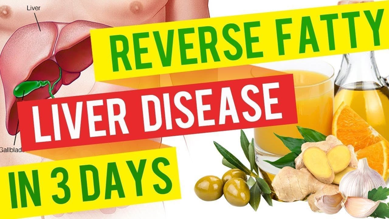 BEST Foods to Eat to KEEP your LIVER HEALTHY. - YouTube