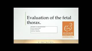 GE Webinar : Evaluation of the Fetal Thorax by Dr Bijoy K Balakrishna