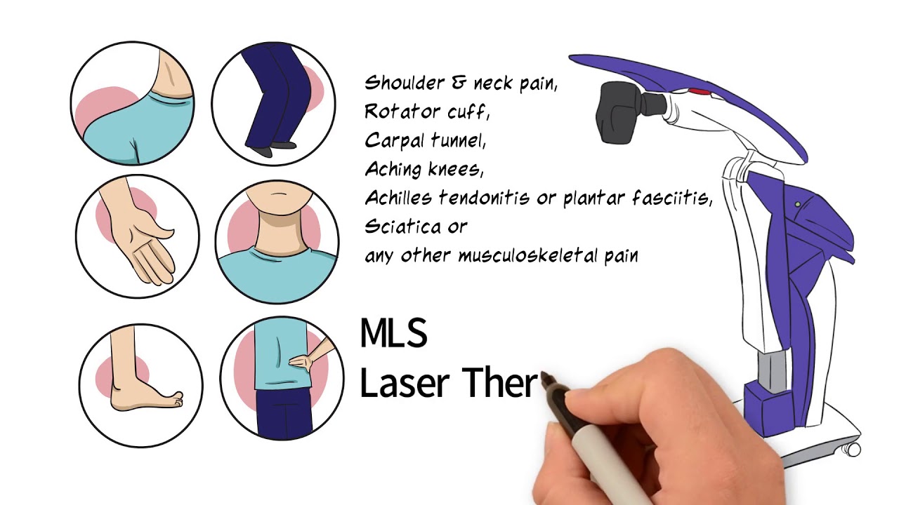 Laser Therapy Will MLS Laser Therapy Work For Me YouTube Laser therapy will mls laser therapy work for me youtube