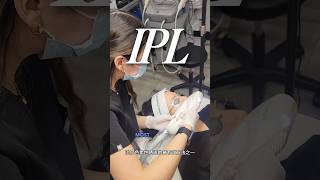 IPL for east asian sun spots ⚡️freckle removal #yyc #yycliving #skincare #dermatology #calgary