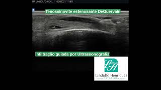 Lindolfo Henriques-15